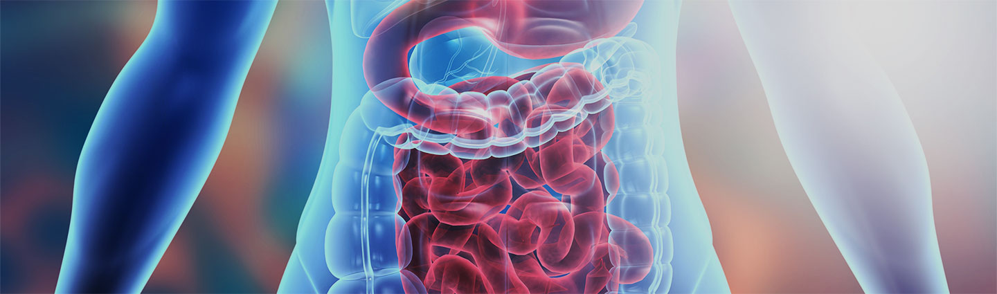 Malattie intestinali